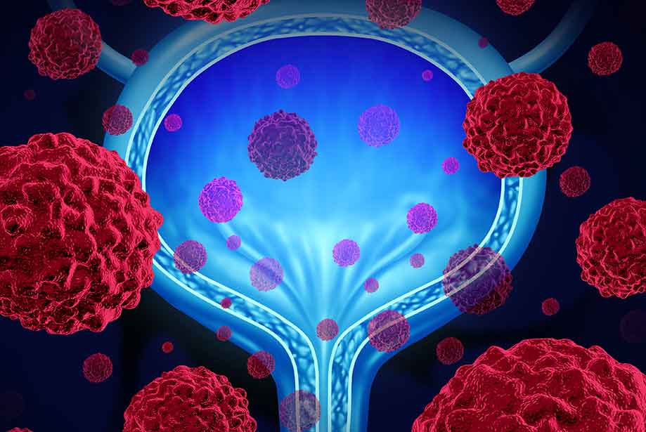 What are the different types of biomarker tests
