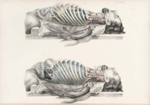 MPhil Morbid Anatomy and Histopathology