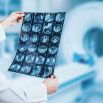 What Is BS Radiography and Imaging Technology